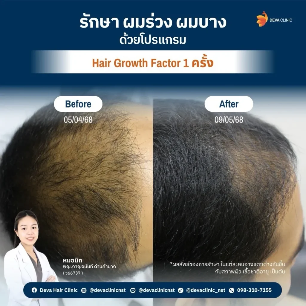 hair 11