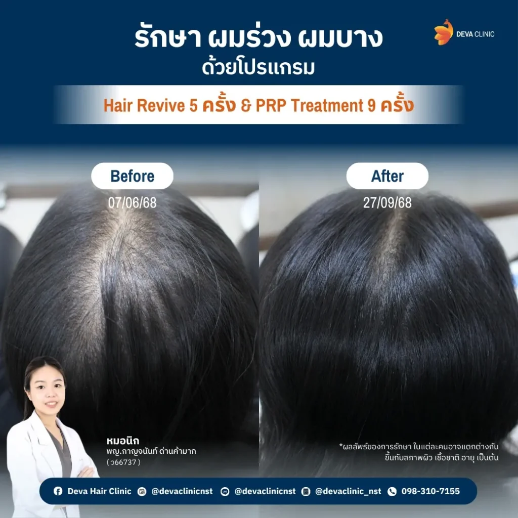 hair 12