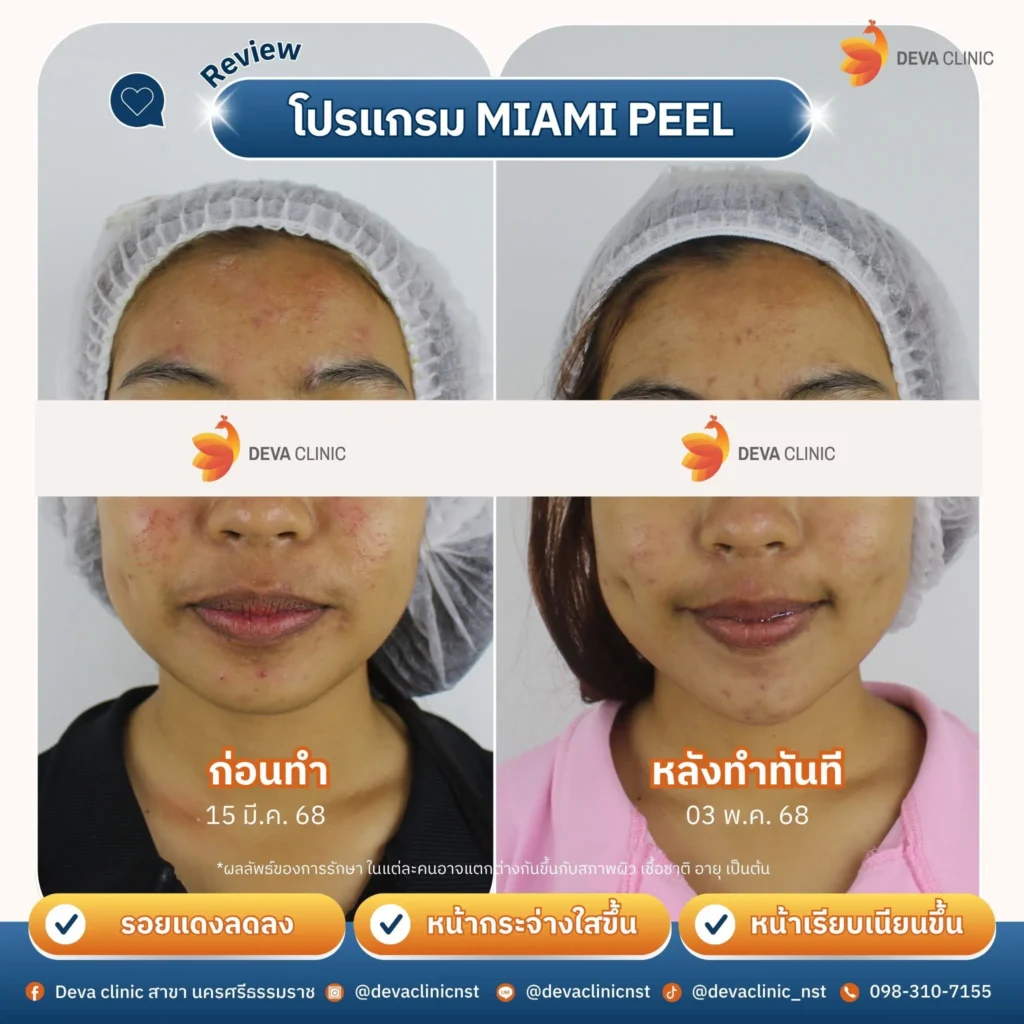 miami peel หน้า 3