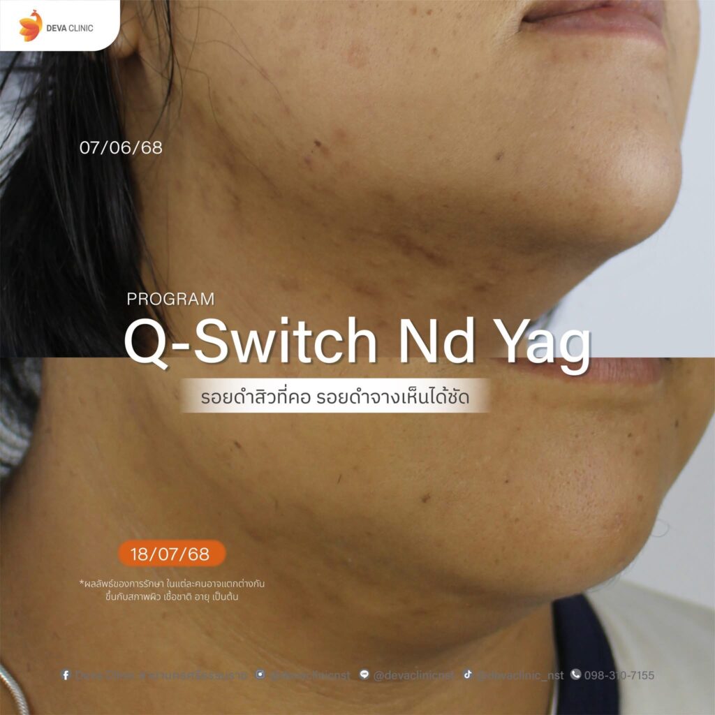 qs หน้า 1