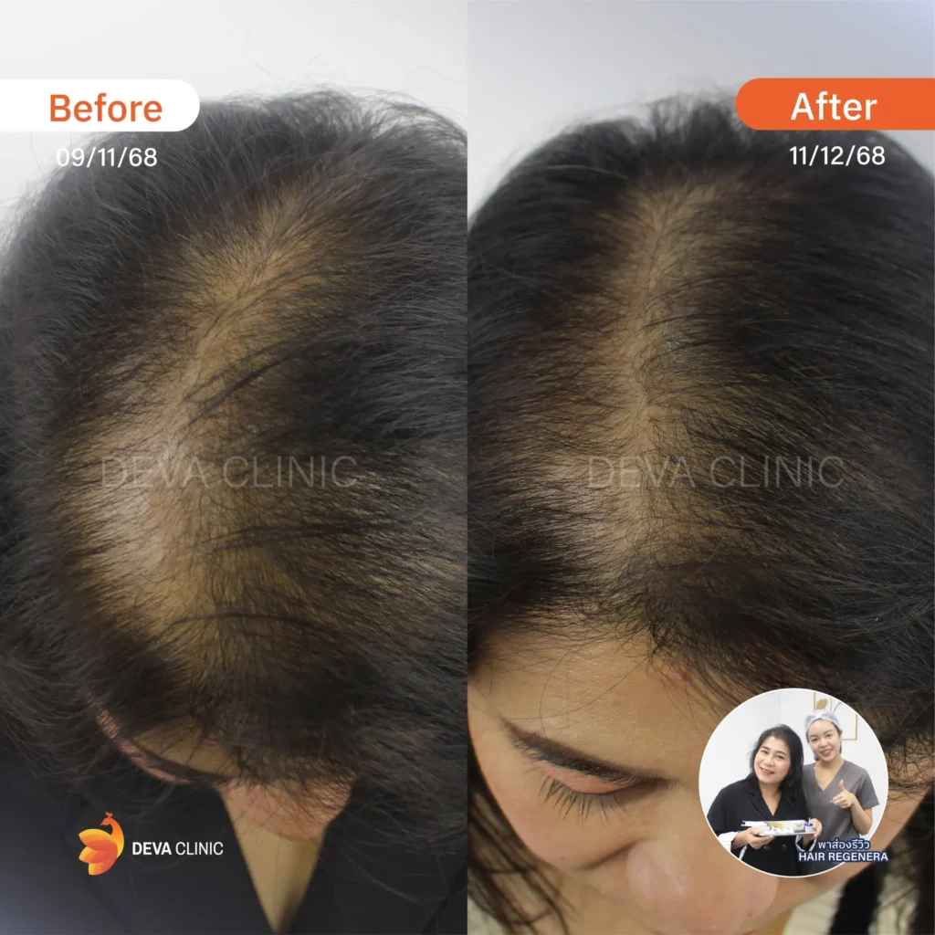 Service-Hair-Regenera hair regenera 9