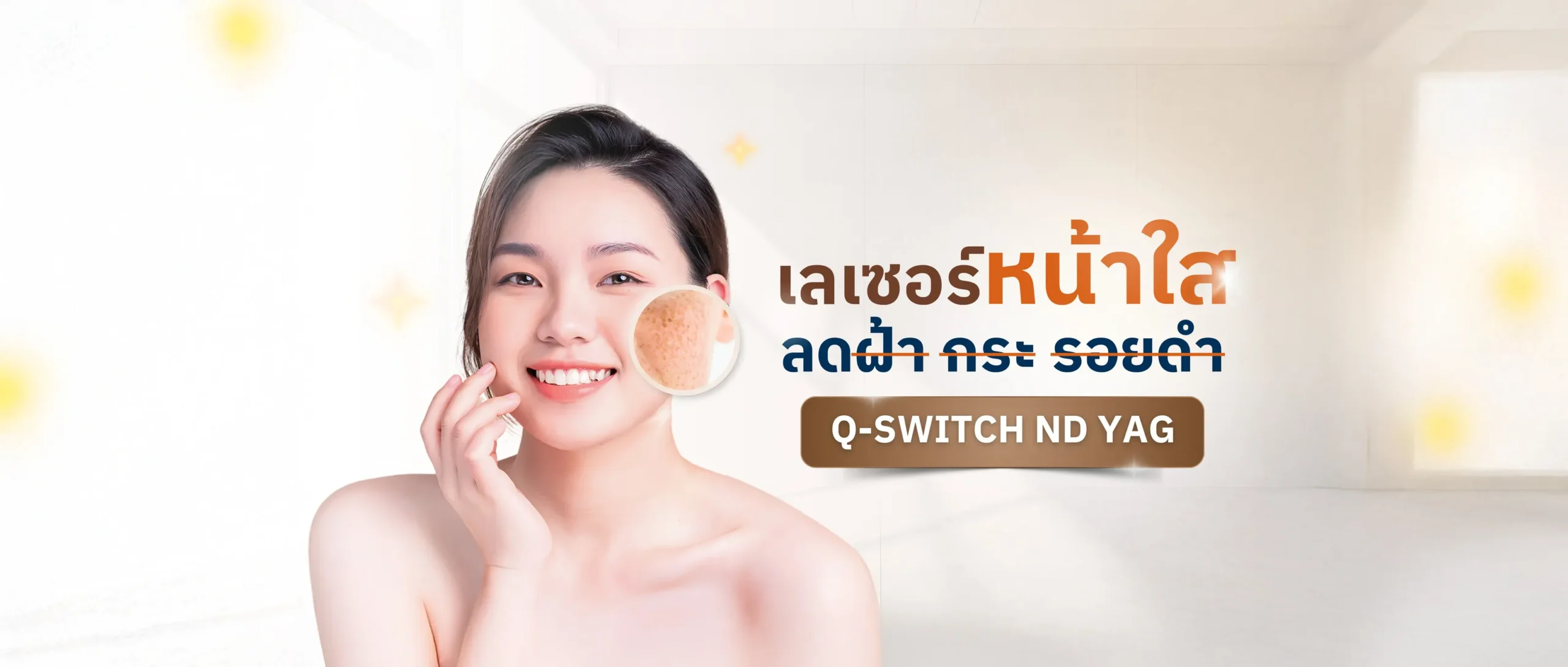 q switch banner