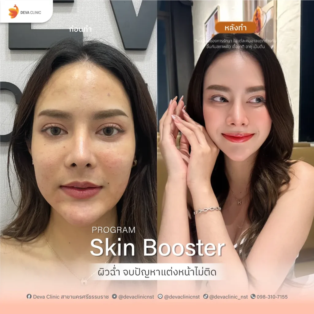 Service-Skin-Booster skin bootster 1