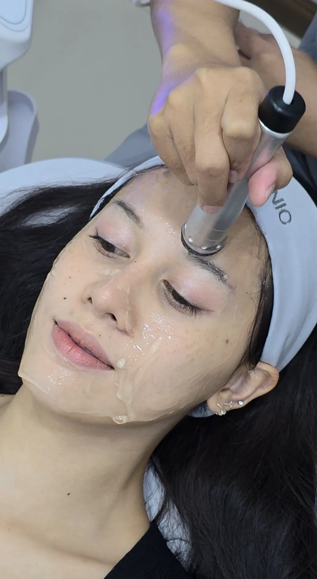 treatment 3